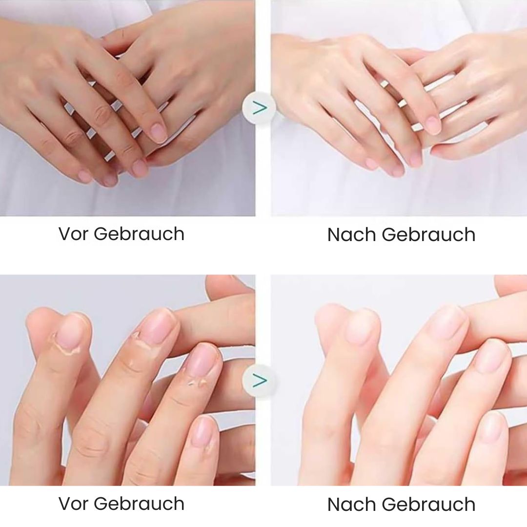 CareClip - Sichere, schmerzfreie Nagelpflege – mit nur einem Klick